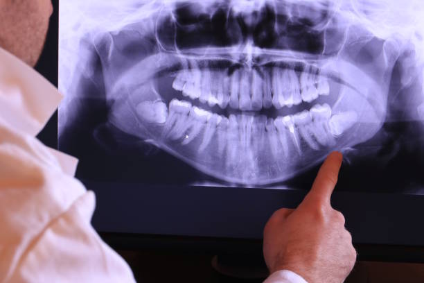Best Emergency Tooth Extraction  in Red Oak, NC