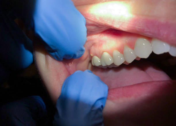 Best Broken Tooth Emergency  in Red Oak, NC