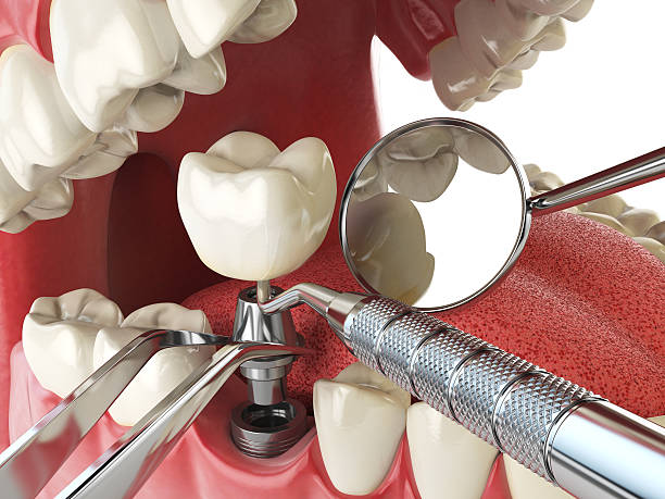 Best Dentist for Tooth Abscess  in Red Oak, NC